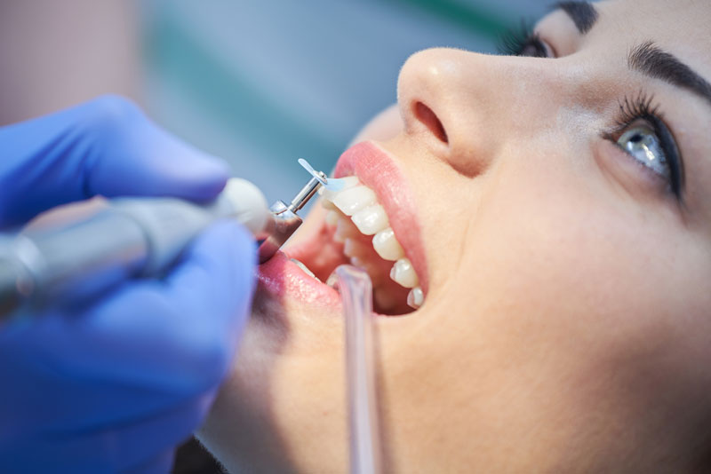 Unveiling the Success of Dental Implants in Reston, VA