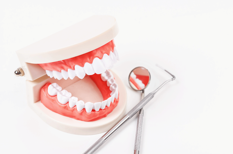 What Are Full Mouth Dental Implants In Woodbridge, VA?
