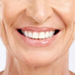 An image of an older woman smiling with porcelain veneers