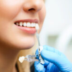 Doctor color matching a veneer for a patient’s tooth; holding device up to patients’ mouth.